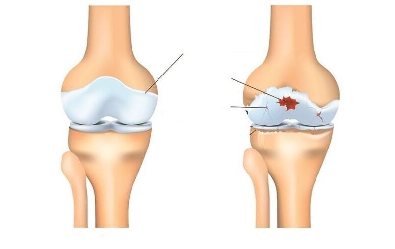 Salud articular y pacientes