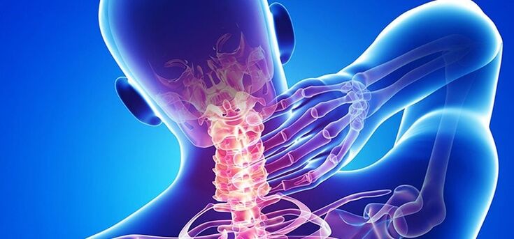 osteocondrosis cervical