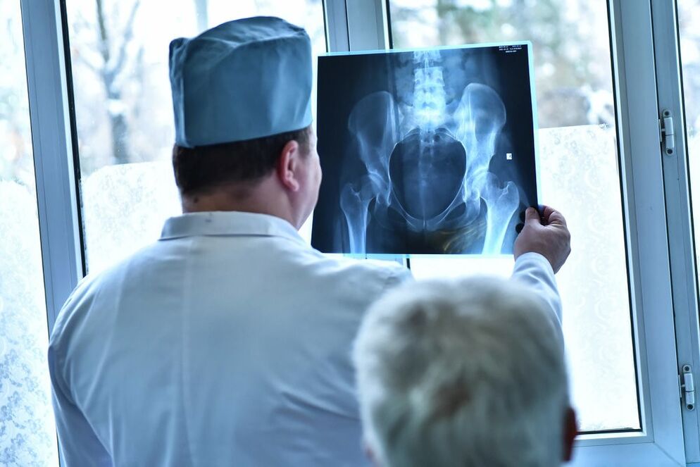 Doctor mirando una imagen de una articulación de cadera artrítica